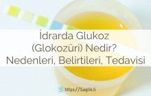 İdrarda glukoz nedir? Glukozüri nedir? İdrarda glukoz belirtileri, nedenleri, tedavisi, idrarda glukoz negatif pozitif, referans aralıkları