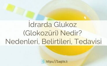 İdrarda glukoz nedir? Glukozüri nedir? İdrarda glukoz belirtileri, nedenleri, tedavisi, idrarda glukoz negatif pozitif, referans aralıkları