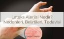 Lateks alerjisi nedir? Lateks alerjisi nedenleri, belirtileri ve tedavisi, nasıl geçer