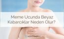 Meme ucunda beyaz kabarcıklar neden olur? Meme ucunda beyaz noktalar, sivilceleri, lekeler nedenleri nelerdir?