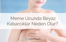 Meme ucunda beyaz kabarcıklar neden olur? Meme ucunda beyaz noktalar, sivilceleri, lekeler nedenleri nelerdir?