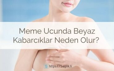 Meme ucunda beyaz kabarcıklar neden olur? Meme ucunda beyaz noktalar, sivilceleri, lekeler nedenleri nelerdir?