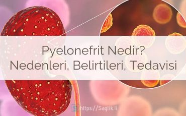 Pyelonefrit Nedir? Nedenleri, Belirtileri ve Tedavisi, piyelonefrit