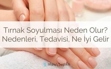 Tırnak soyulması neden olur? Tırnak soyulmasına ne iyi gelir? Tırnak soyulması nasıl önlenir?