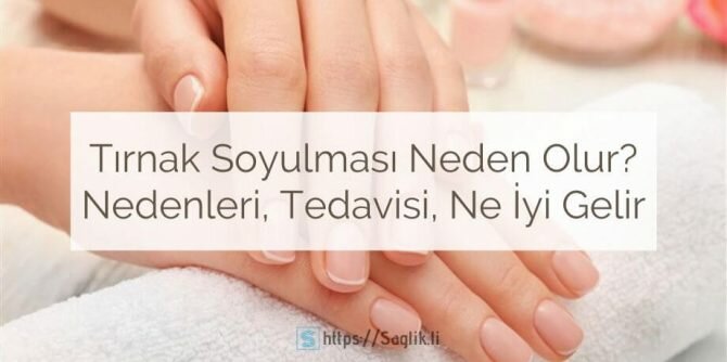 Tırnak soyulması neden olur? Tırnak soyulmasına ne iyi gelir? Tırnak soyulması nasıl önlenir?